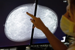 The surprising way breast cancer screenings could reveal heart disease  The Washington Post