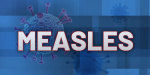Potential measles exposure linked to eastern Iowa hotel  KCRG