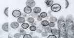 Hantavirus and COVID Similar fears major differences  WRAL