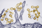 MN resident possibly exposed to Hantavirus  KELOLANDcom