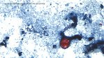 Outbreak of diarrhea caused by cyclosporiasis spreading in US with cases reported in CA CDC says  ABC7 Los Angeles