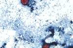 As cyclospora illnesses surge to a record Michigan officials eye lettuce as a possible cause  AP News