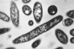 Second death reported in Legionnaires disease outbreak in New York City  AP News