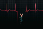 No one knew why she fainted so often A clinical trial gave her hope  The Washington Post