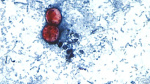 First deaths reported in cyclosporiasis outbreak  CNN