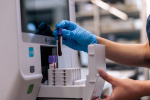 The sneaky kind of cholesterol that may be threatening your heart health  The Washington Post