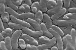 Health officials urge caution for Gulf Coast beachgoers during surge of deadly bacterial infections  AP News