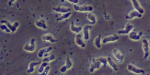 North Carolina teen critically injured by rare braineating amoeba  FOX Weather