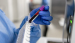 Column  Im an oncologist Every man should know this about prostate cancer  The Washington Post