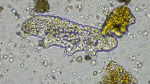 NC teen dead after contracting rare braineating amoeba found in freshwater health officials confirm  ABC11 News