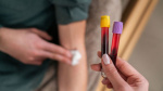First on CNN Routine blood testing may hold hidden clues to colorectal cancer before age 45  CNN