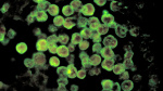 Teens braineating amoeba infection likely linked to water feature  USA Today