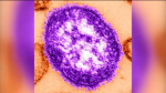 Phila health officials warn of possible measles exposure at Philadelphia International Airport  6abc Philadelphia