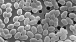 Eating sugar while taking antibiotics might harm gut bacteria  CNN