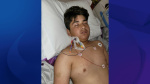 Long Beach child hospitalized with rare disease related to West Nile virus  KTLA