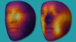 How a photo of a persons face could help predict whether theyll survive cancer treatment  CNN